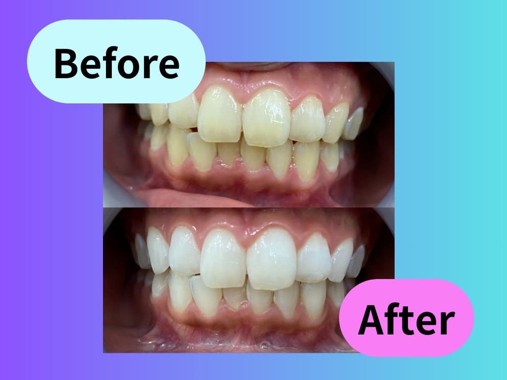 PLUS ONEのサービス